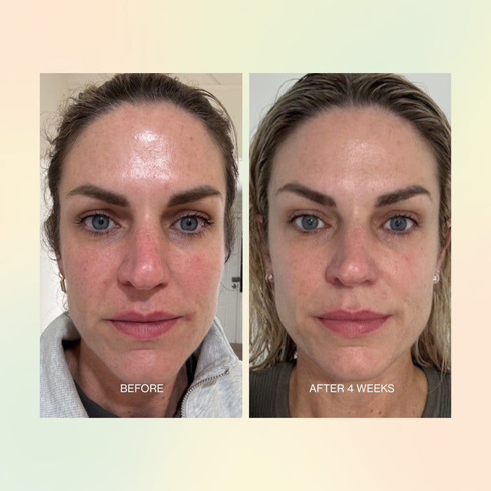 Before and after comparison of a woman's face with text indicating time elapsed.