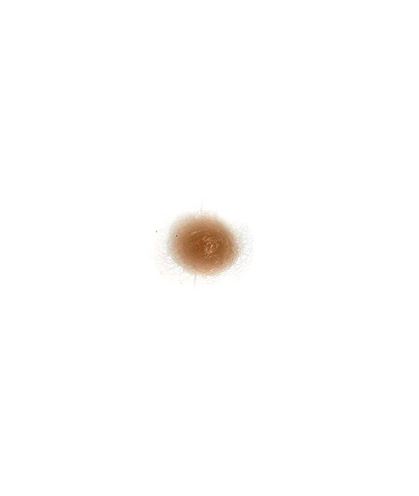 X Small boil