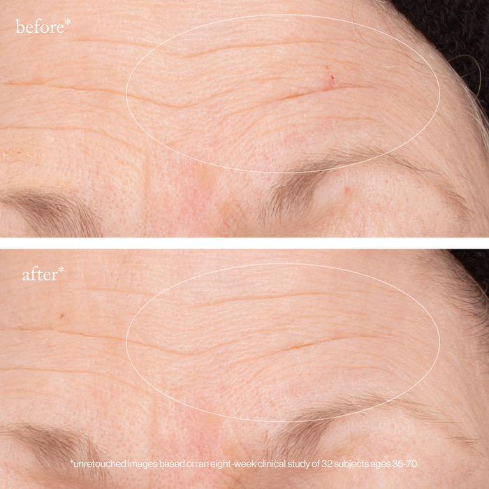 Goop-3X Retinol Regenerative Serum-Skincare-3xretinolregenerativeserum_imgCarousel_beforeandafter-The Detox Market |
