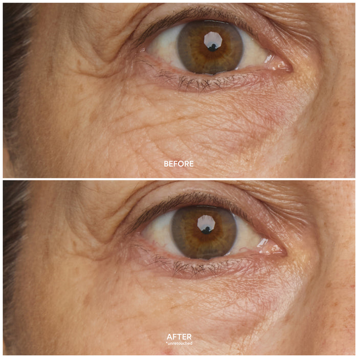 True Botanicals-Chebula Multi-Corrective Eye Patches-Skincare-S-W-D-UEPT-R_4-The Detox Market |