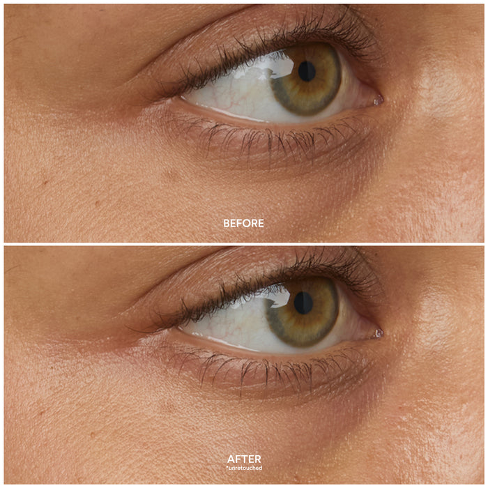 True Botanicals-Chebula Multi-Corrective Eye Patches-Skincare-S-W-D-UEPT-R_5-The Detox Market |