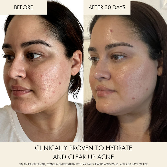 MARA-Niacinamide + Copper Clear Skin Mineral Milk-Skincare-MARA-CSMM-30_3-The Detox Market |