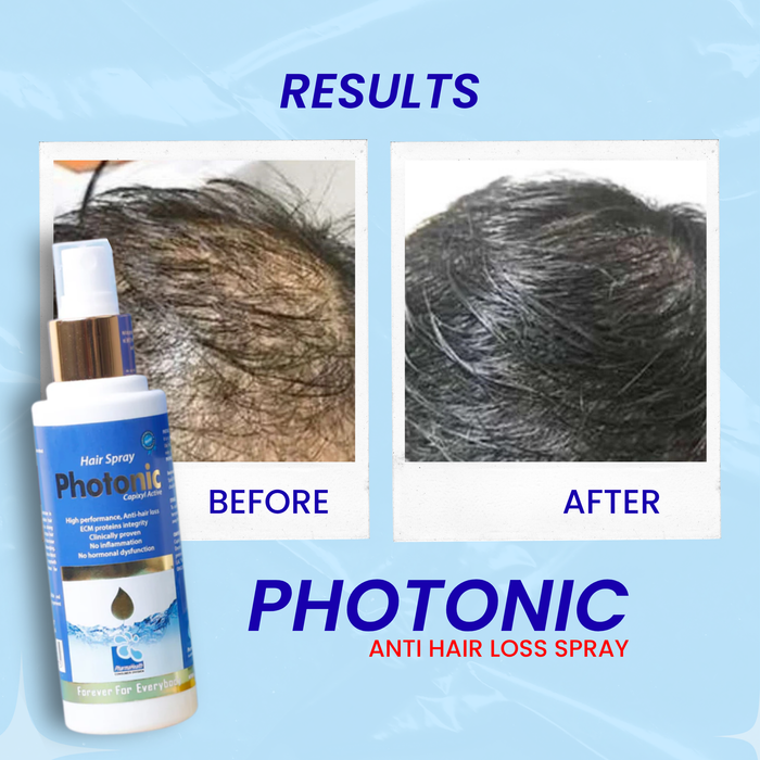 Photonic Hair Spray Anti Hair Loss