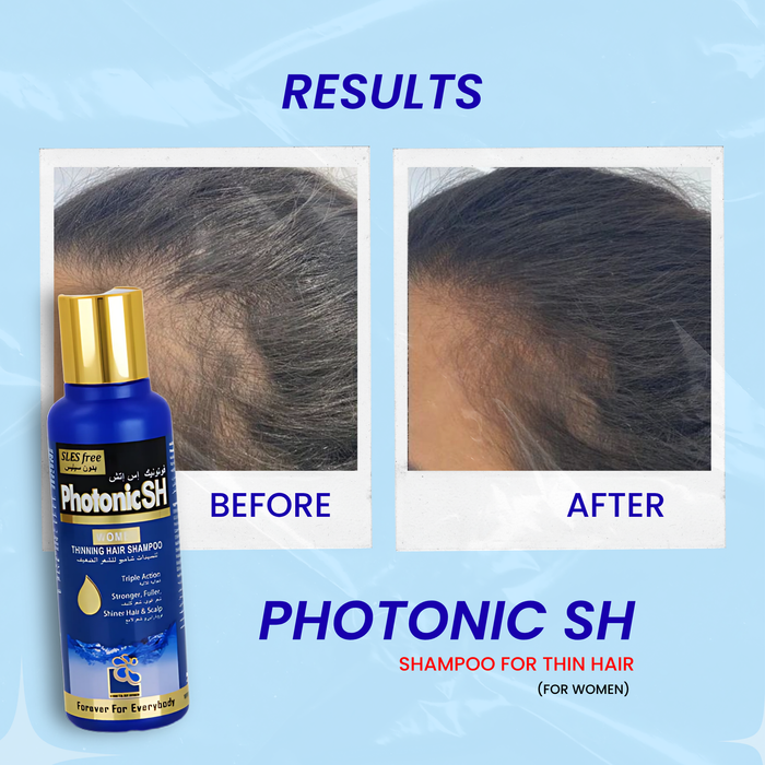 Photonic SH Shampoo for Thin Hair (for WOMEN)
