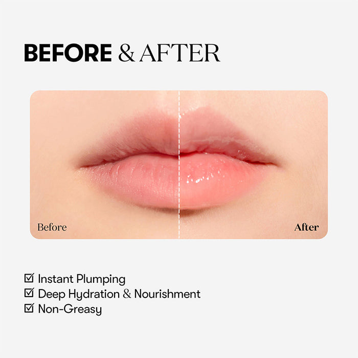 Reedle Shot Lip Plumper Beginner