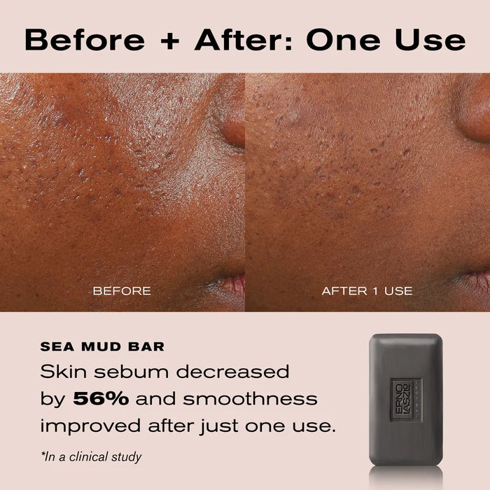 Before and after comparison of skin texture on a person's cheek, with text stating 'Before + After: One Use' and 'SEA MUD BAR' plus a small dark gray soap bar shown on the right.