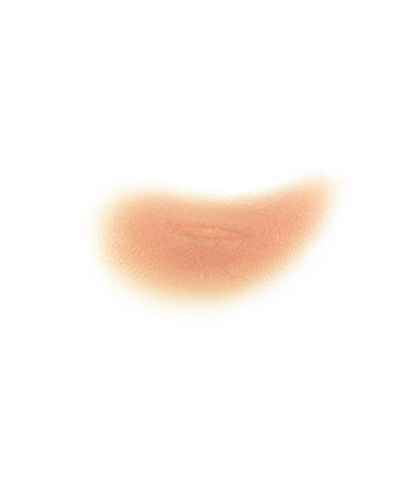 Swollen Cheekbone with cut (right)