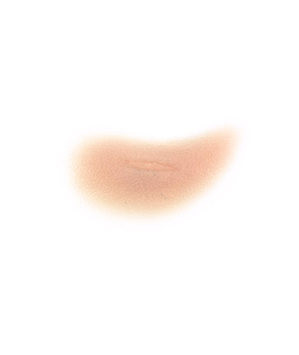 Swollen Cheekbone with cut (right)