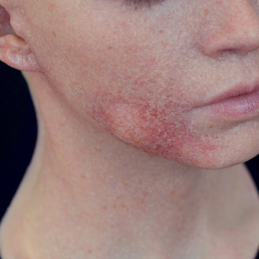 Swollen Lump 4