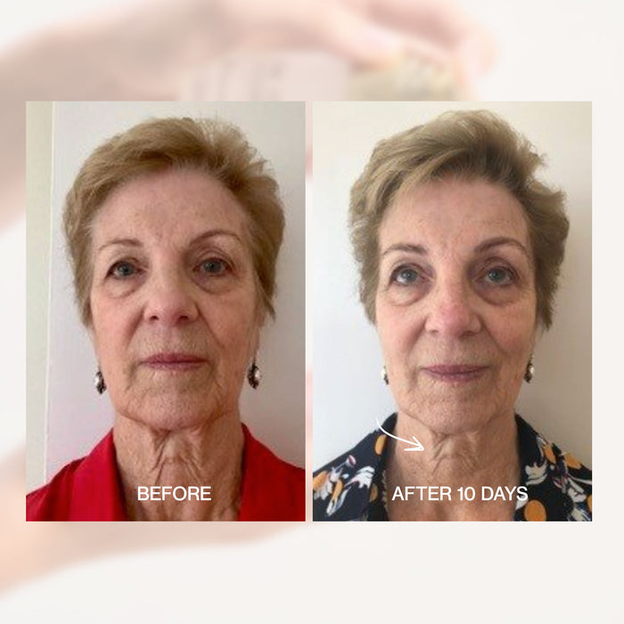 Before and after comparison of a woman's face with text indicating time elapsed.