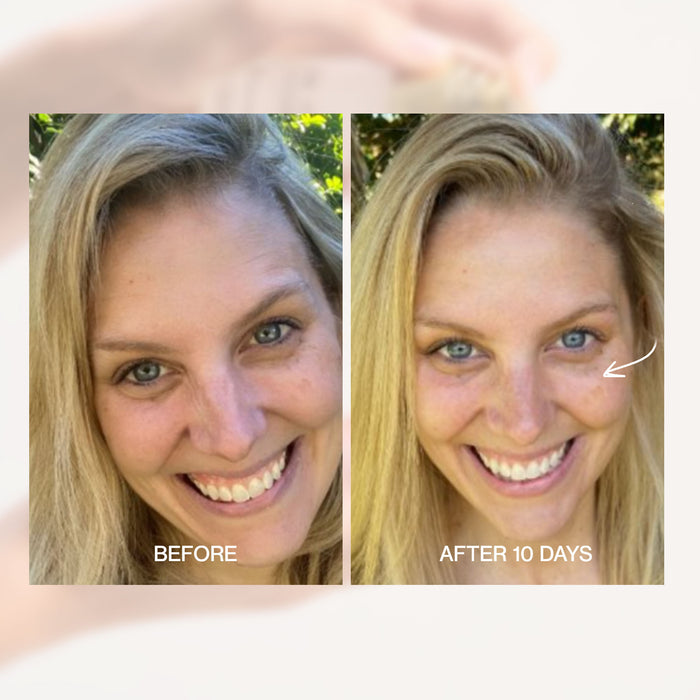 Before and after comparison of a woman's face with text indicating a time lapse.