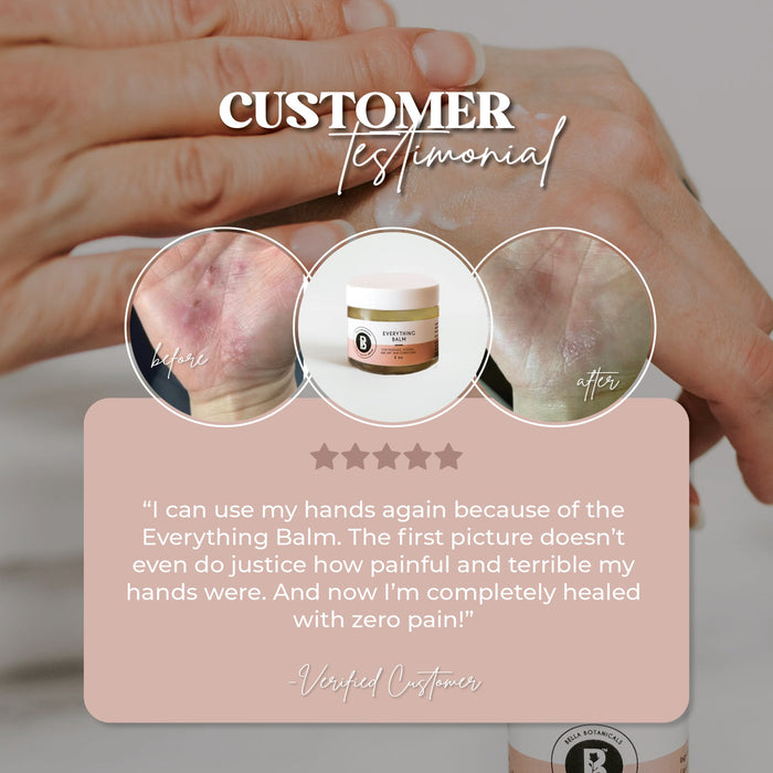 Everything Balm for Dry Skin Conditions (Psoriasis and Eczema) - Bella Botanicals