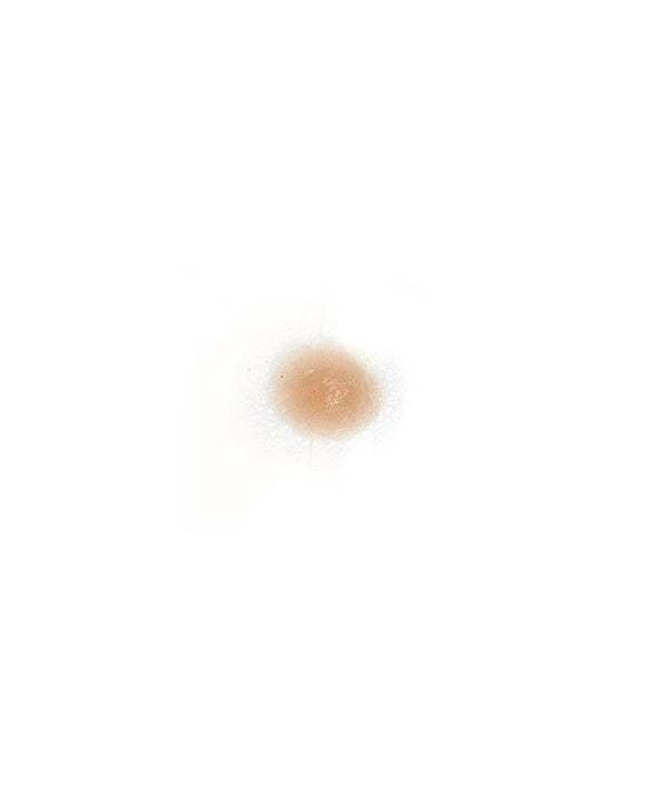 X Small boil