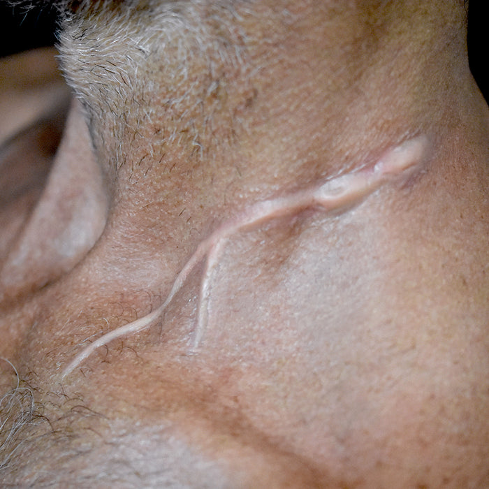 Y Scar 3