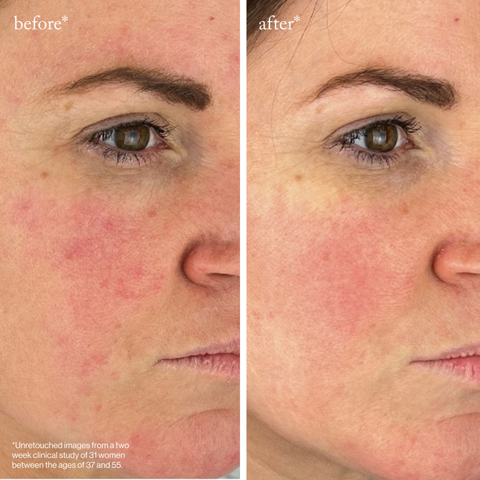 Goop-Youth-Boost Peptide Serum-Skincare-youthboostpeptideserum_imgCarousel_beforeandafter_db4ad840-ad15-4394-8100-5cd7033a70a0-The Detox Market |